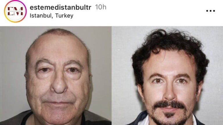 بالفيديو.. صاحب صورة عملية التجميل "المعجزة" يكشف الحقيقة