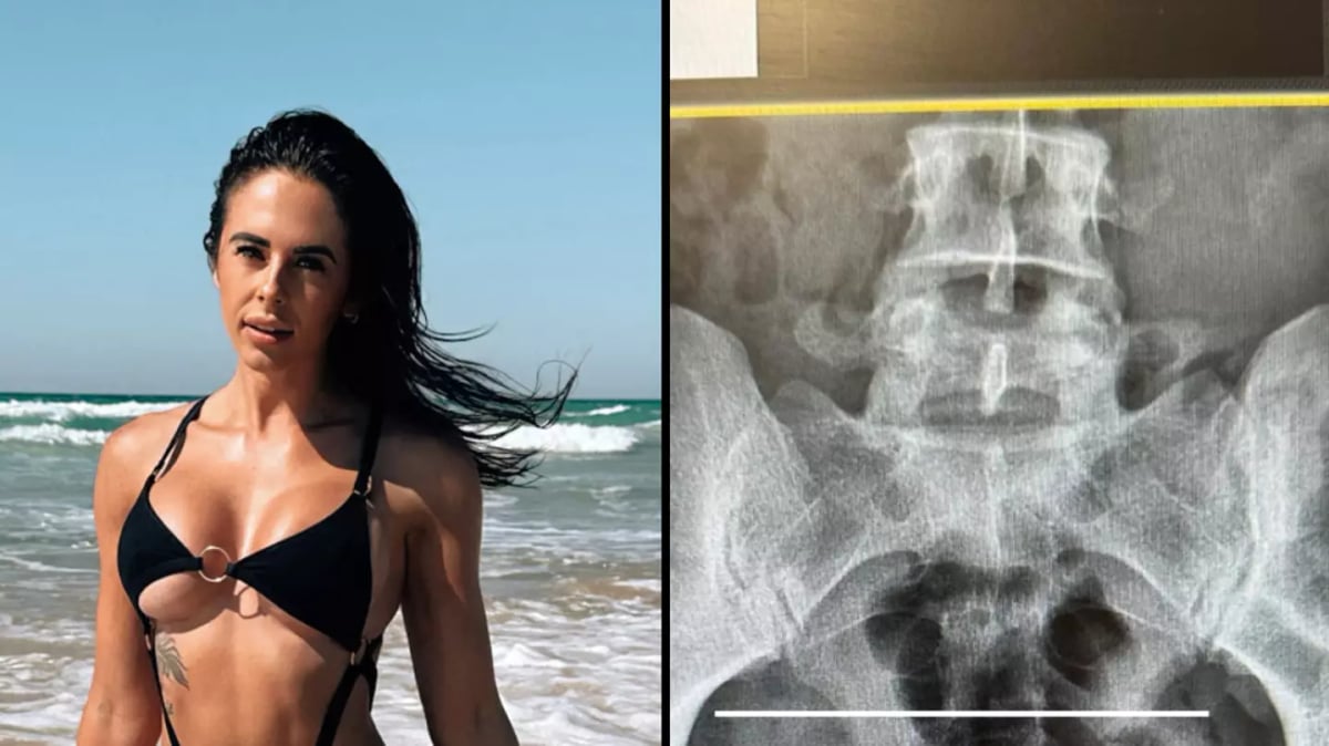 حادث غريب خلال العلاقة الحميمة.. إليك التفاصيل