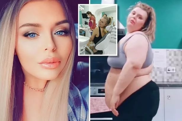 من السمنة إلى السوشيال ميديا.. كيف غيّرت جراحة تركيا حياة لورين إيفنز