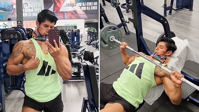 مكسيكي يتحدى السرطان بعد إزالة 90% من فكه
