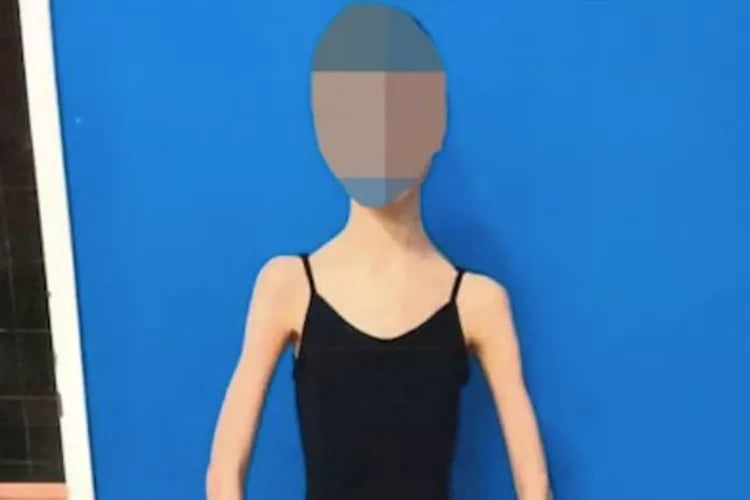 لإبقائها صغيرة إلى الأبد.. أب وأم يجوّعان ابنتهما بشكل صادم