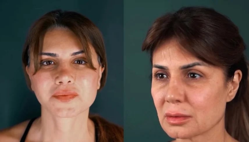 نجلاء بدر تستعيد شبابها بعملية تجميل ناجحة!