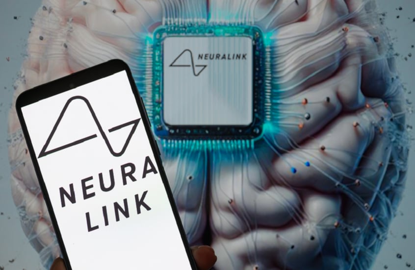 إنجاز جديد لـNeuralink.. مريض يحرر فيديو باستخدام إشارات دماغه (فيديو)