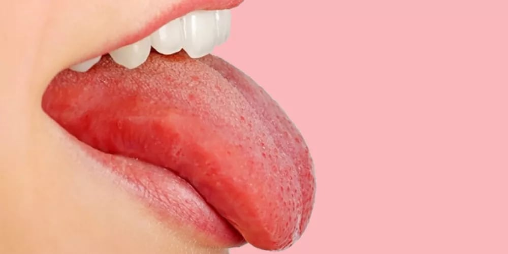 اللسان ليس فقط للكلام.. هو مرآة المعدة !
