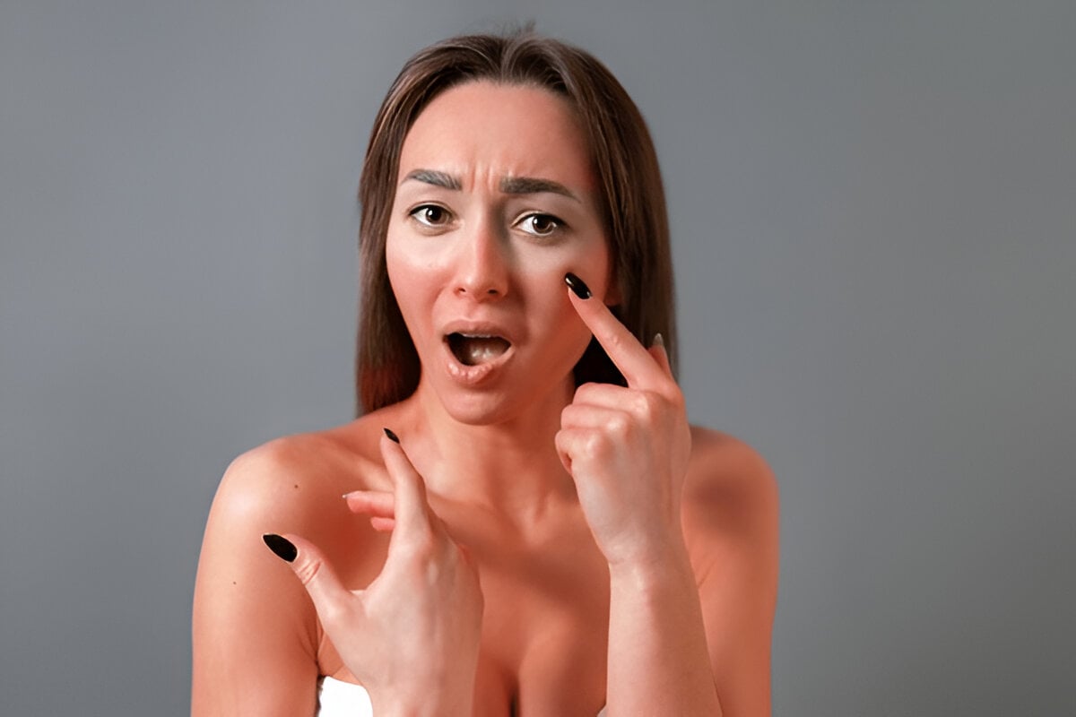 أدوية شائعة قد تجعل بشرتك أكثر عرضة لحروق الشمس الشديدة
