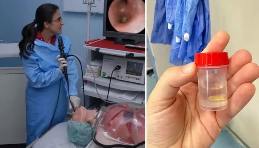 حادثة غريبة.. سيدة كادت تفقد حياتها بسبب وجبة أكلتها قبل 5 أشهر!