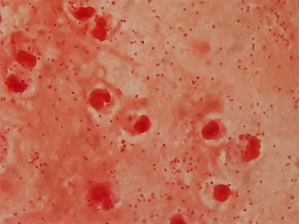 Study Reveals Decades of Genetic Adaptation Behind Global Superbug Threat