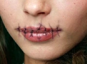 امرأة تخيط شفتي جارتها في اليابان لمنعها من الكلام