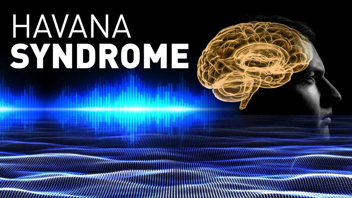 Syndrome de La Havane : le débat sur les causes persiste