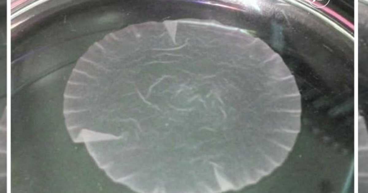 أول عملية تجارية لزراعة خلايا جذعية للقلب