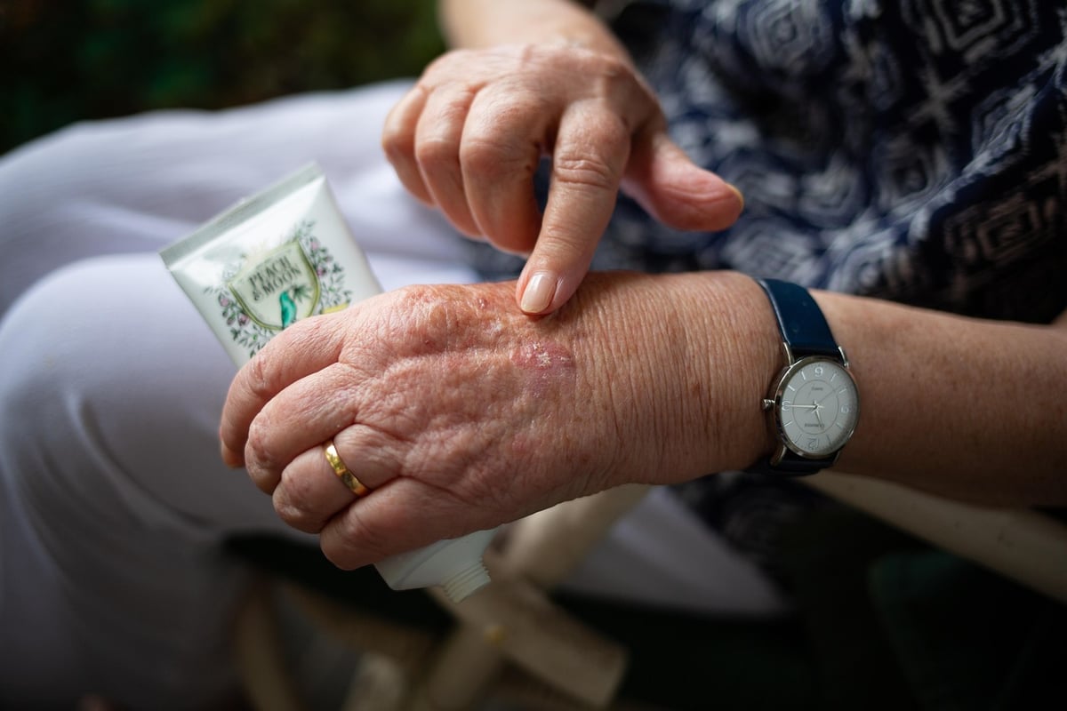 hand cream, elderly, skin care, grandparent, grandmother, skin, old, senior, hand, aged, aging, wrist, rub, cream, tube, watch, wedding ring, granny, blemish, arthritis, cosmetics, arthritis, arthritis, arthritis, arthritis, arthritis
