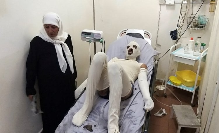 مصر ترسل فريق طبي متخصّص في جراحة الحروق